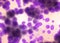 Purple bacteria