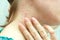 Purulent rashes on the neck of woman. Allergy, acne. Skin diseases