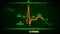 QT Interval of Electrocardiogram Wave or ECG or EKG