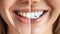 Radiant Smile Transformation: Dental Whitening Before and After