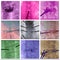 Radiofrequency ablation spinal vertebrae colorful collage