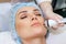 Radiofrequency facial skin lifting