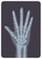 Radiograph, X-radiation picture or X-ray image of hand or palm with wrist and fingers. Modern medical radiography and