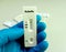 Rapid test cassette for Rubella Virus rapid screening test, showing positive IgM result.