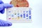 Reagent Strip for biochem and drug sensitivity test for identifield pathogen