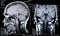 Real MRI Scans of the Head and Brain