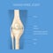 Realistic 3d Detailed Human Knee Joint Anatomy Concept Card. Vector