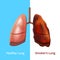 Realistic Detailed 3d Human Lungs Internal Organ. Vector