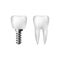 Realistic healthy white tooth and implant with screw. Dentistry and dentist care. Vector