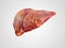 Realistic illustration of cirrhosis of human liver