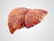 Realistic illustration of cirrhosis of human liver