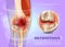 Realistic Illustration Orthopedics Medicine in 3d