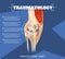 Realistic Illustration Traumatology Medicine in 3d