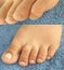 Realistic pedicure, chiropody: before and after