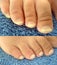 Realistic pedicure, chiropody: before and after