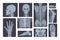 Realistic x-ray shots collection. Human body hand, leg, skull, foot, chest, teeth, spine and other.