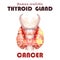 Realistic thyroid gland in low poly. Inflammation cancer Human 3