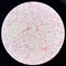 Red cell gram negative bacilli in hemo culture