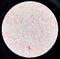 Red cell gram negative bacilli in hemo culture