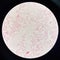 Red cell gram negative bacilli in hemo culture