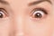 Red eyes woman with allergic reaction conjunctivitis irritated bloodshot eye inflammation. Closeup of shocked upset person with