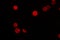 Red hexagonal bokeh lights on dark background