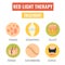 Red light therapy treatment. Set of icons