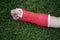 Red wrist arm and hand cast