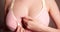 reddened breast feeding mothers. Close-up of a girl's breast suffering from mastitis or lactostasis. slow motion