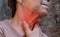 Redness at neck of Asian woman. Concept of sore throat, pharyngitis, laryngitis, thyroiditis, or dysphagia