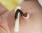 Remains of the umbilical cord with a clip in a newborn. Treatment and care of the navel in an infant. Close-up