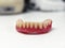 Removable dentures for the patient are made in a dental laboratory