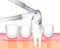 Removal of the patient`s tooth. Dental tool forceps. Dentistry-surgical treatment of toothache. Vector illustration