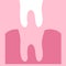 Removal of a tooth. Tooth and gum on a pink background. Dentistry.