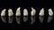 Removed diseased human teeth stacked in a row on a black background. Close-up photo of spoiled molars and premolars.
