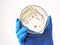 Researcher is holding Petri dish of Vibrio vulnificus in CHROMagar and TCBS, an estuarine bacterium which occurs in in filter-feed