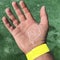 The resort of salt lakes. A man shows his palm covered with salt after swimming in the salt pool. A wristband on the wrists to