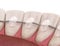 Retainers dental installed after braces treatment, Medically accurate dental 3D illustration