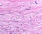 Reticular dermis. Human skin