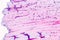 Retina human under microscope.