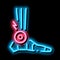 rheumatoid arthritis of foot neon glow icon illustration