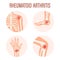 Rheumatoid arthritis icons. Knee joint, shoulder joint, wrist joint, foot joint. Types of arthritis. Medical concept.