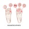 RHEUMATOID DISEASE LEG Artritis Medicine Education Scheme