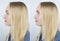 Before and after rhinoplasty. The girl corrects the crooked nose. On the left, the woman has a crooked nose, on the right, it is