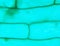 Rhode flagellate protozoa under a microscope (Allium Scale Eugle