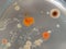 Rhodotorula candida and other fungi and bacteria