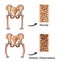 Rickets-osteomalacia