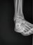 Right ankle x-ray. Downward scan