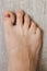 Right foot on the floor. Damaged nail. Bruise under thumb nail. Barefoot close up. Nail illness. Health treatment.