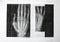 Right hand x ray image